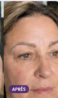 Sourcils de Nadia après utilisation