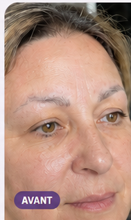 Sourcils de Nadia avant utilisation