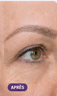 Sourcils de Sophie après utilisation